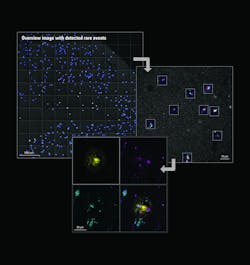 FIGURE 2. Study of proteins involved in neurodegenerative diseases. Visualization of microglial activity (TSPO) and engulfment (Homer1 and CD68) around amyloid-plaque (MX04) in 50-μm-thick human brain sections (Alzheimer’s disease donors). Duration of automated image acquisition: ~5 hours. Objects of interest: 3D high-resolution image stacks of 516 detected rare events. FIGURE 2. Study of proteins involved in neurodegenerative diseases. Visualization of microglial activity (TSPO) and engulfment (Homer1 and CD68) around amyloid-plaque (MX04) in 50-μm-thick human brain sections (Alzheimer’s disease donors). Duration of automated image acquisition: ~5 hours. Objects of interest: 3D high-resolution image stacks of 516 detected rare events.