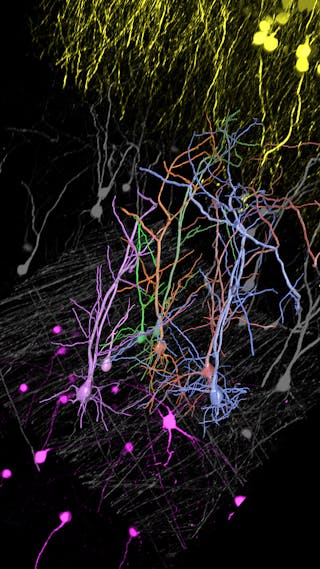 FIGURE 4. THY1-EGFP labeled neuron in whole mouse brain processed using the PEGASOS 2 tissue clearing method, imaged on a Leica confocal microscope. Neurons were traced using Aivia&rsquo;s 3D Neuron Analysis&ndash;FL recipe from Leica Microsystems.