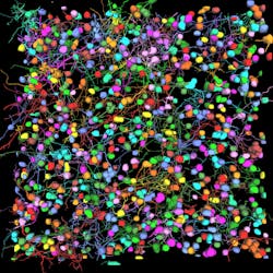 FIGURE 5. THY1-EGFP labeled neurons in mouse brain processed using the PEGASOS 2 tissue clearing method. Neurons were traced using Aivia’s 3D Neuron Analysis–FL recipe with Cellpose for soma detection. FIGURE 5. THY1-EGFP labeled neurons in mouse brain processed using the PEGASOS 2 tissue clearing method. Neurons were traced using Aivia’s 3D Neuron Analysis–FL recipe with Cellpose for soma detection.