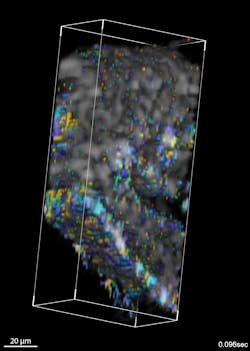 FIGURE 2. This image shows volumetric mapping of fluctuations produced by cilia on the surface of grooves within the fallopian tube. FIGURE 2. This image shows volumetric mapping of fluctuations produced by cilia on the surface of grooves within the fallopian tube.