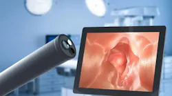 chiefrayangle_illuminatingendoscopy_sprecisionpath