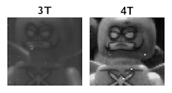 FIGURE 3. Comparison of 3T and 4T pixel images.