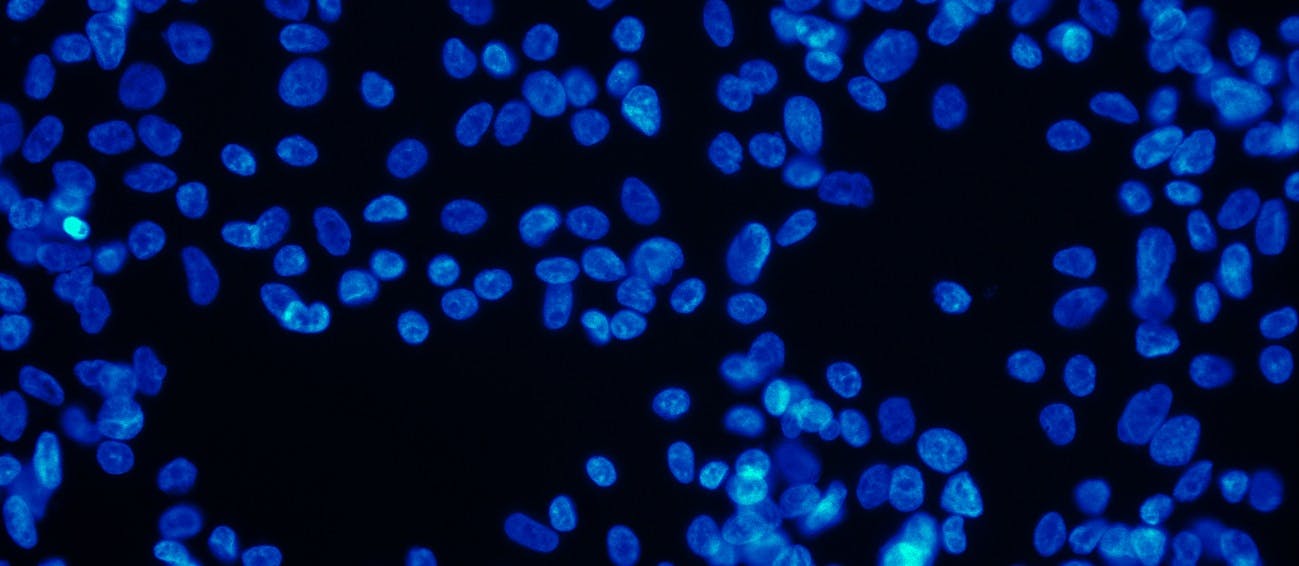 6615b8e16c5160001fc2cf6d Hero Image565