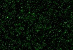 Figure 5. Star image in focus position Figure 5. Star image in focus position