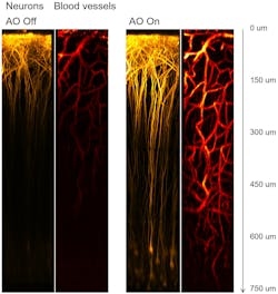 FIGURE 2. 3P imaging of mouse neurons and vasculature through the intact skull with adaptive optics. FIGURE 2. 3P imaging of mouse neurons and vasculature through the intact skull with adaptive optics.