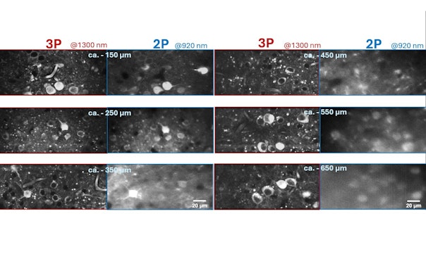 FIGURE 1. Image quality in 2P vs. 3P microscopy as a function of depth in mouse brain.