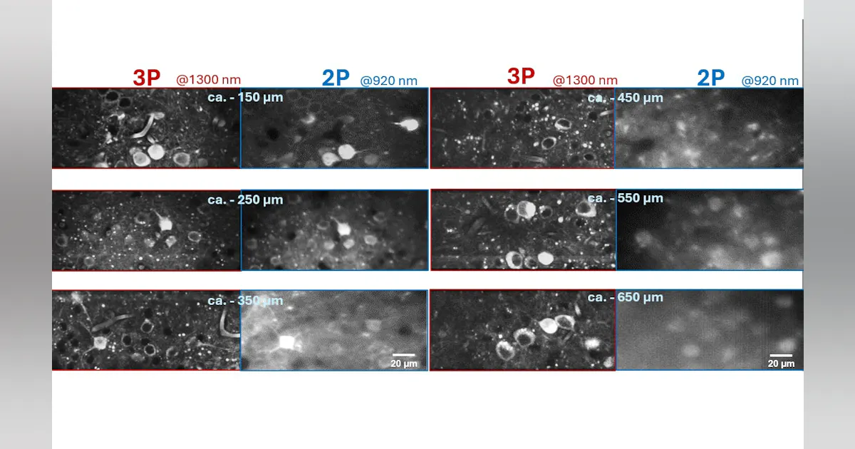 Proton Microscopy Three-photon microscopy comes of age | Laser Focus World