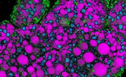 Structures containing different lipid subtypes in the fat body tissue in a fruit fly. Each lipid subtype has a different molecular composition represented by a different color. Structures containing different lipid subtypes in the fat body tissue in a fruit fly. Each lipid subtype has a different molecular composition represented by a different color.