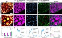 PRM-SRS imaging of Drosophila fat body cells detects different lipid subtypes and their subcellular distributions.