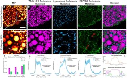 PRM-SRS imaging of Drosophila fat body cells detects different lipid subtypes and their subcellular distributions. PRM-SRS imaging of Drosophila fat body cells detects different lipid subtypes and their subcellular distributions.