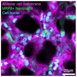 FIGURE 3. High-powered objectives including 20x and 60x oil-immersion objectives used with the crystal ribcage to image cell migration. FIGURE 3. High-powered objectives including 20x and 60x oil-immersion objectives used with the crystal ribcage to image cell migration.