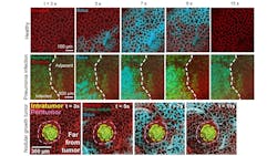 FIGURE 4. Remodeled capillary function around established tumor nodules and in pneumonia-infected lungs. FIGURE 4. Remodeled capillary function around established tumor nodules and in pneumonia-infected lungs.