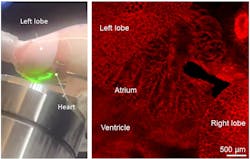 FIGURE 5. Atrial flutters at high vascular pressures imaged in real time with the crystal ribcage. FIGURE 5. Atrial flutters at high vascular pressures imaged in real time with the crystal ribcage.