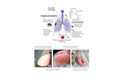 FIGURE 1. The concept of the crystal ribcage; it leverages optical microscopy for high-resolution and real-time probing of lung function in health and disease (top). Biocompatible and transparent, the ribcage houses the functional ex vivo mouse lung (bottom). FIGURE 1. The concept of the crystal ribcage; it leverages optical microscopy for high-resolution and real-time probing of lung function in health and disease (top). Biocompatible and transparent, the ribcage houses the functional ex vivo mouse lung (bottom).