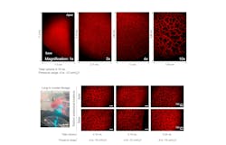 FIGURE 2. Truly multiscale and real-time imaging of the ventilated lung from whole-lobe down to alveolar scales under negative pressure ventilation (top); distinct anatomical regions from apex to base can be imaged over the entire surface of the lung inside the crystal ribcage, shown here during negative-pressure ventilation (bottom). FIGURE 2. Truly multiscale and real-time imaging of the ventilated lung from whole-lobe down to alveolar scales under negative pressure ventilation (top); distinct anatomical regions from apex to base can be imaged over the entire surface of the lung inside the crystal ribcage, shown here during negative-pressure ventilation (bottom).