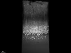 FIGURE 1. A 3D image of a live mouse brain acquired using an Evident FV4000 MPE microscope and a 25x TruResolution objective. FIGURE 1. A 3D image of a live mouse brain acquired using an Evident FV4000 MPE microscope and a 25x TruResolution objective.