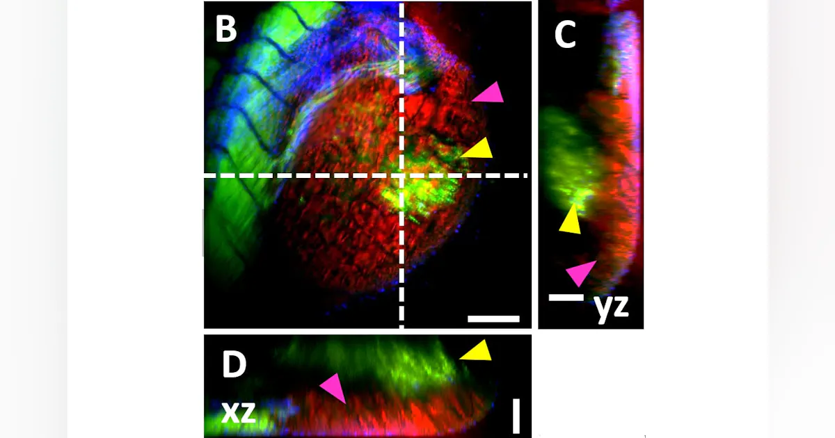 Bioimaging Image Bioimaging: Is it possible to improve the performance of microscopes ...