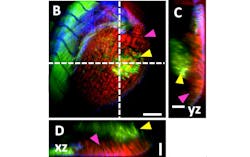 FIGURE 1. 3D volume scan of a xenograft (yellow arrow) model in a zebrafish larvae imaged with TPEF and label-free CARS microscopy; the label-free CARS signal is depicted in red and indicated by pink arrow. Scale bar: 100 µm. FIGURE 1. 3D volume scan of a xenograft (yellow arrow) model in a zebrafish larvae imaged with TPEF and label-free CARS microscopy; the label-free CARS signal is depicted in red and indicated by pink arrow. Scale bar: 100 µm.