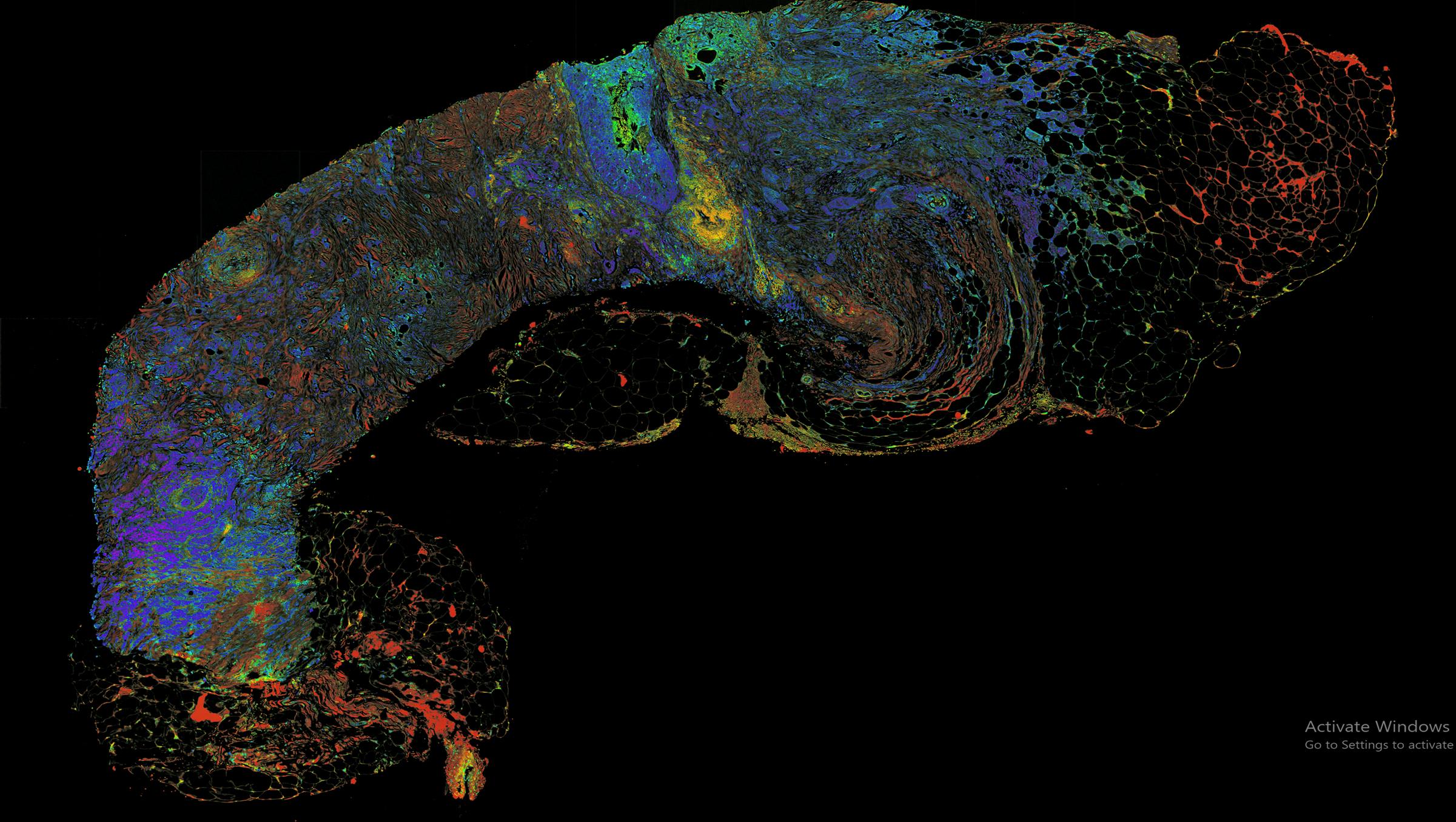 FIGURE 4. Photon absorption remote-sensing picture of a sample.