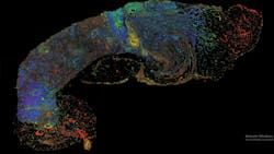FIGURE 4. Photon absorption remote-sensing picture of a sample. FIGURE 4. Photon absorption remote-sensing picture of a sample.