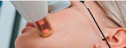 Transforming Skincare with Laser Optics Transforming Skincare with Laser Optics