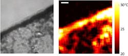 FIGURE 3. The temperature was mapped around dispersed gold nanorods. An optical image shows the distribution of the nanorods on glass (left); a temperature map was made of the same area (right). Larger temperature increases are observed where the nanorods are agglomerated; that is, where the nanorod concentration is higher. (The white bar is 2 µm long.) FIGURE 3. The temperature was mapped around dispersed gold nanorods. An optical image shows the distribution of the nanorods on glass (left); a temperature map was made of the same area (right). Larger temperature increases are observed where the nanorods are agglomerated; that is, where the nanorod concentration is higher. (The white bar is 2 µm long.)
