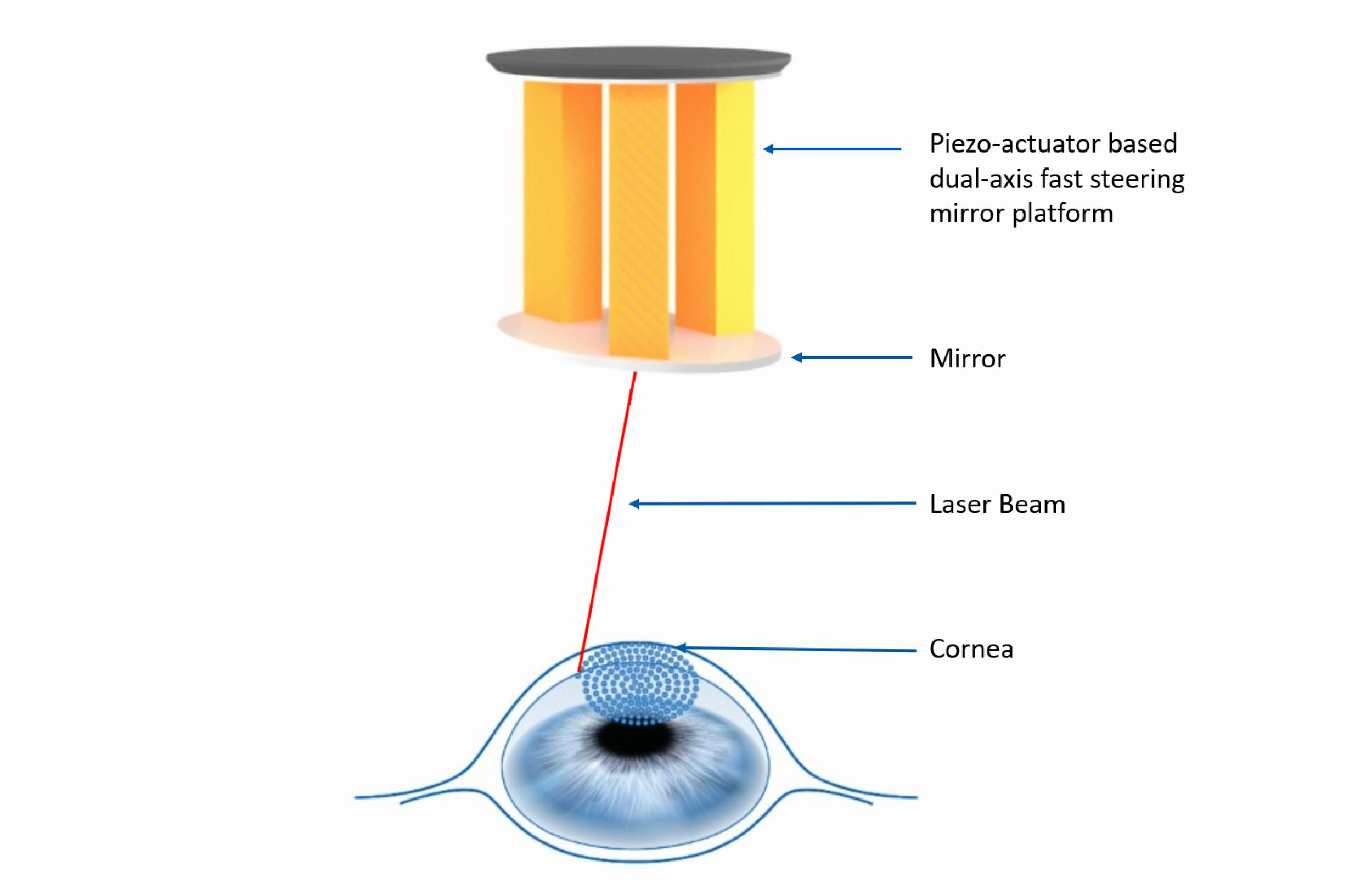 FIGURE 4. FSM for an eye surgery application.