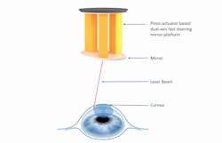 FIGURE 4. FSM for an eye surgery application. FIGURE 4. FSM for an eye surgery application.