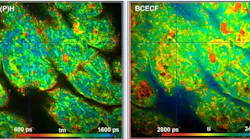 Metabolic FLIM with Simultaneous pH Imaging