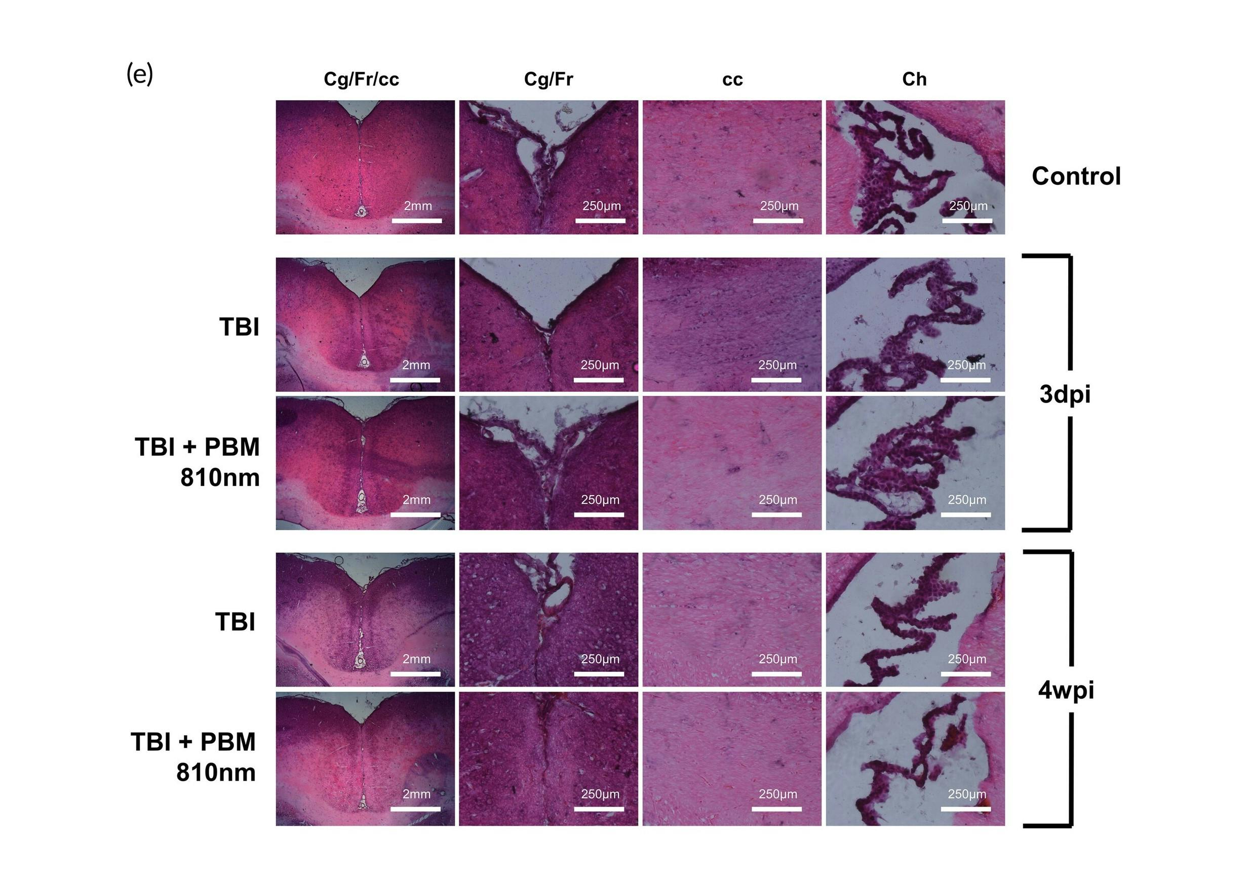 H&E staining on rat brain coronal slices from all treatment conditions at three days post-injury and four weeks post-injury. Images were taken from frontal cortex, corpus callosum, and choroid plexus (body of the lateral ventricle).