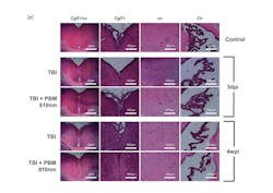 H&E staining on rat brain coronal slices from all treatment conditions at three days post-injury and four weeks post-injury. Images were taken from frontal cortex, corpus callosum, and choroid plexus (body of the lateral ventricle). H&E staining on rat brain coronal slices from all treatment conditions at three days post-injury and four weeks post-injury. Images were taken from frontal cortex, corpus callosum, and choroid plexus (body of the lateral ventricle).
