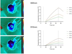Images of FLIR thermal profiling taken from the internal skull surface (right), and temporal plots of thermal change (maximum temperature) for a region of interest on the internal skull surface (left). Images of FLIR thermal profiling taken from the internal skull surface (right), and temporal plots of thermal change (maximum temperature) for a region of interest on the internal skull surface (left).