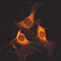 FIGURE 1. A two-photon image excited at 930 nm using DiI staining lipids in NIH 3T3 cells was taken using a Chameleon laser with Zeiss LSM 510 META microscope system.