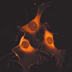 FIGURE 1. A two-photon image excited at 930 nm using DiI staining lipids in NIH 3T3 cells was taken using a Chameleon laser with Zeiss LSM 510 META microscope system. FIGURE 1. A two-photon image excited at 930 nm using DiI staining lipids in NIH 3T3 cells was taken using a Chameleon laser with Zeiss LSM 510 META microscope system.