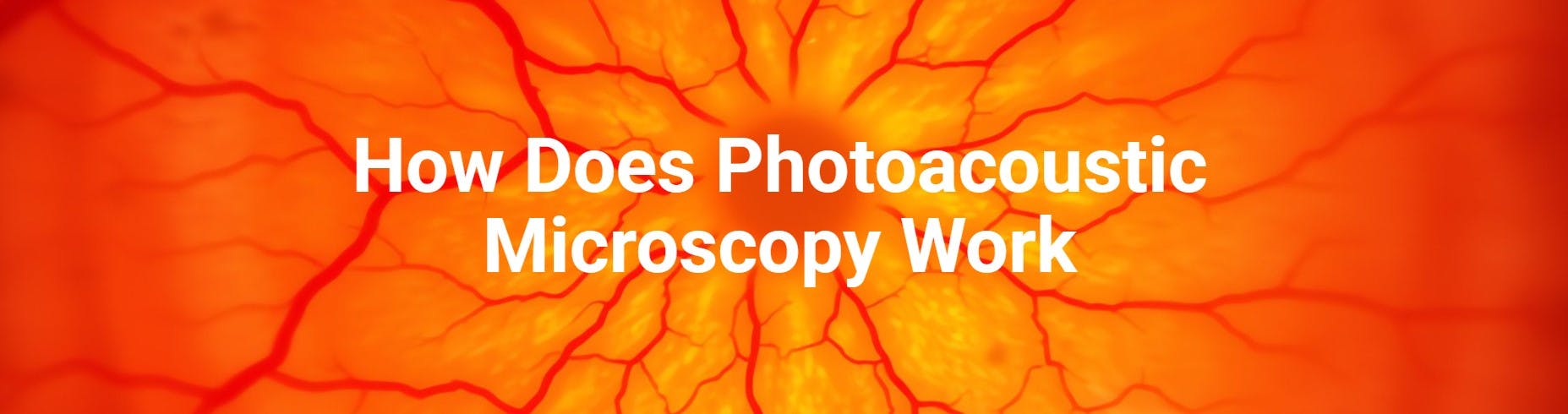 Photoacoustic Microscopy