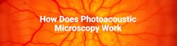 Photoacoustic Microscopy Photoacoustic Microscopy