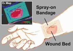 A transparent liquid bandage displays a quantitative, oxygenation-sensitive color map that can be easily acquired using a simple camera or smartphone. A transparent liquid bandage displays a quantitative, oxygenation-sensitive color map that can be easily acquired using a simple camera or smartphone.