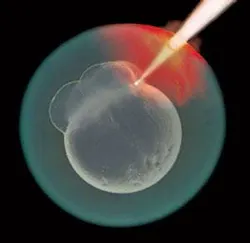By focusing femtosecond laser pulses (10–15 fs/pulse) through the chorion of a zebrafish embryo, researchers at the University of Alberta (Canada) were able to create laser-induced transient pores at the blastomere-yolk interface of the embryo and in individual blastomere cells. The resulting pores were used as delivery pathways to introduce a fluorescent reporter molecule into the cells.