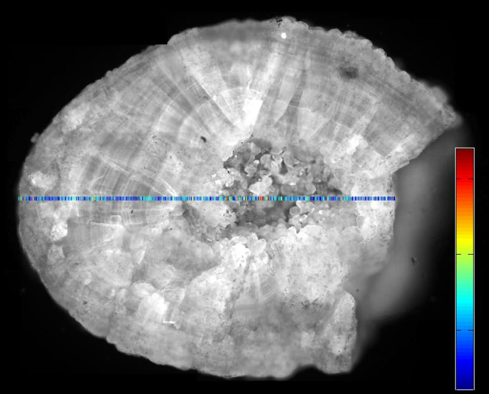 The new diagnostic system makes intermediate postoperative kidney stone analysis possible. Here, a stone is being analyzed automatically using Raman spectroscopy.