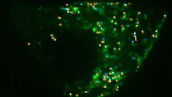 The motion of insulin-containing vesicles, which contain thousands of insulin molecules within an insulin-secreting cell, was studied via particle-tracking software. This work stimulated collaborative research that led to the development of the single-pixel interior filling function (SPIFF) by scientists at the University of Chicago.