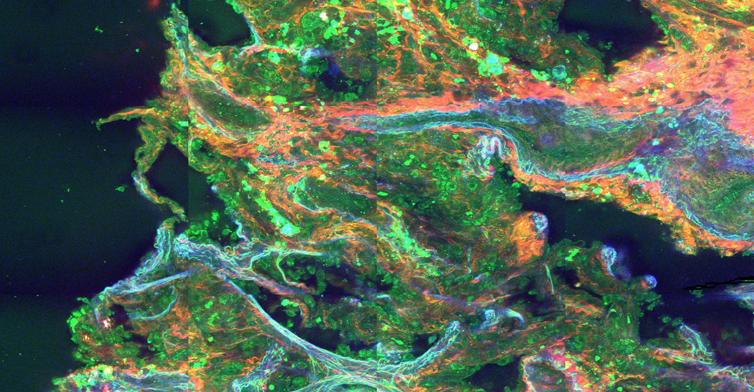 hubner_photonics_white_paper_lung_tissue_valo