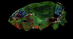 widefield__dapistained_mouse_head widefield__dapistained_mouse_head