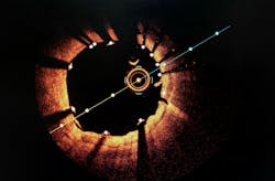 cardio_oct cardio_oct