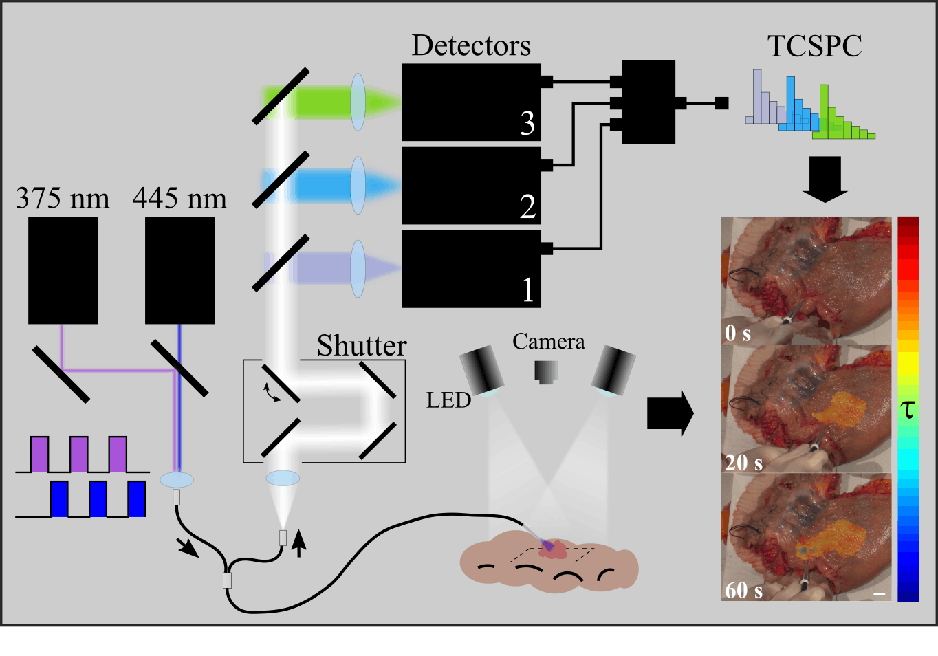 The team&rsquo;s AI-assisted autofluorescence lifetime imaging setup accurately differentiates malignant from benign tissue in real time.