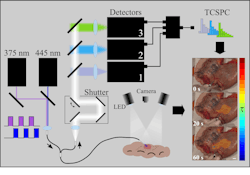 The team’s AI-assisted autofluorescence lifetime imaging setup accurately differentiates malignant from benign tissue in real time. The team’s AI-assisted autofluorescence lifetime imaging setup accurately differentiates malignant from benign tissue in real time.
