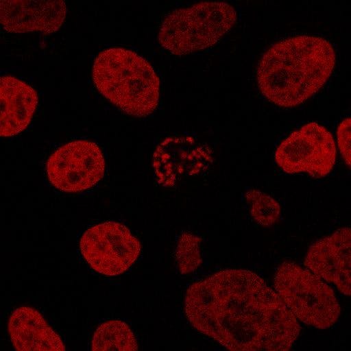 Micropilot analyzes low-res images, identifies cells or structures of interest, and then automatically instructs the microscope to start an experiment.