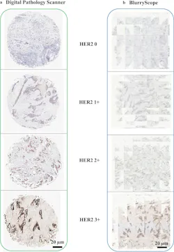 HER2 image comparison.