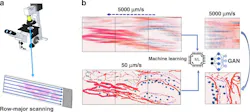 Generative adversarial network.