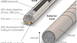 Less than a millimeter in diameter, the latest version of the falloposcope incorporates separate illumination fibers for OCT and multispectral fluorescence imaging (MFI; 125 μm single-mode and 130 μm multimode, respectively); a three-lens, 300 μm distal objective for MFI; a bundle of 3000-element optical fiber for imaging; and two pull wires to enable steering of the imaging element during the assessment procedure.